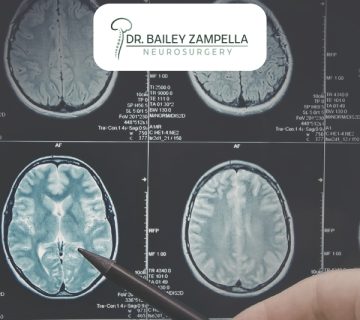 Functional neurosurgery blog dr bailey zampella