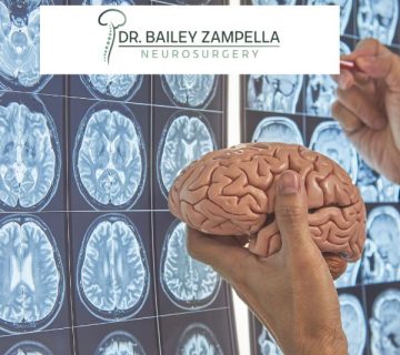 Neuromodulation Explained: How Electrical Stimulation Can Calm the Brain Dr  Zampella blog