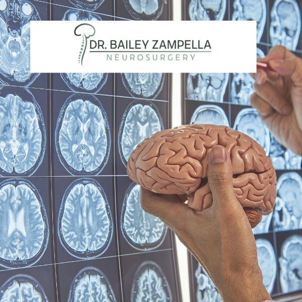 Neuromodulation Explained: How Electrical Stimulation Can Calm the Brain Dr Zampella blog