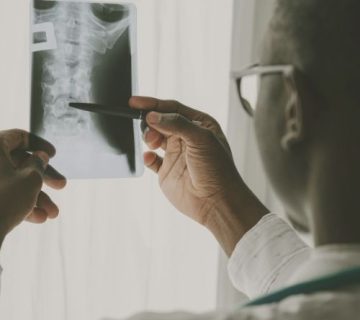 A person wearing glasses examines a spine X ray, holding the film up to the light and pointing at it with a pen 