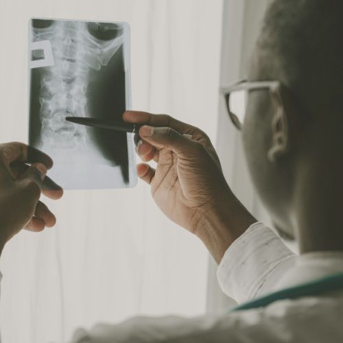 A person wearing glasses examines a spine X ray, holding the film up to the light and pointing at it with a pen 