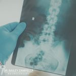 A gloved hand holds a spinal X ray film showing the lumbar region, labeled with an "R"; branding at the bottom reads "Dr  Bailey Zampella Neurosurgery 